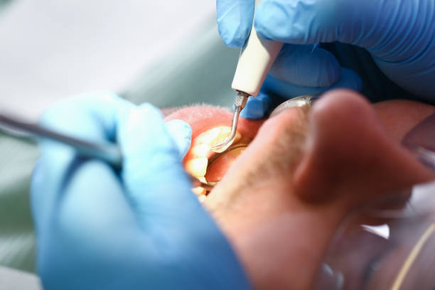 Best Emergency Dental Care for Broken or Chipped Teeth in Brenham, TX